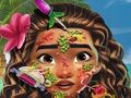 Gêm Meddyg Croen Moana  ar-lein