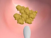 Gêm Clinig Earwax  ar-lein