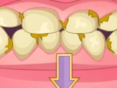 Gêm Bad Teeth Makeover ar-lein