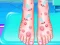 Gêm Emma Foot Treatment ar-lein
