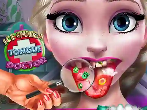 Gêm Ice Queen Tongue Doctor ar-lein