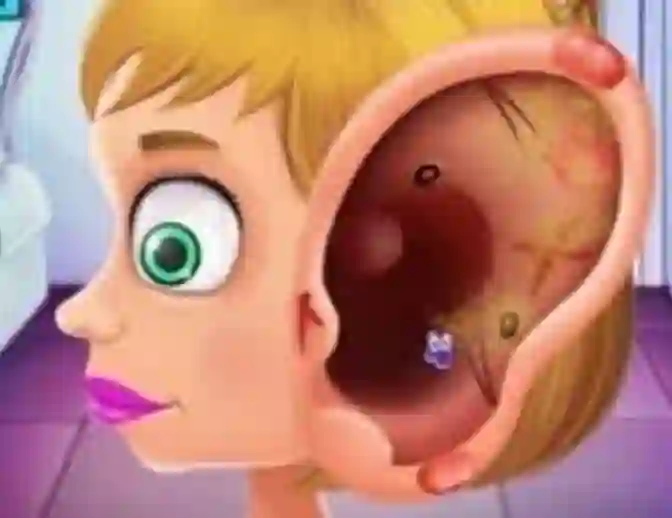 Gêm Children's Doctor Treating Ears ar-lein
