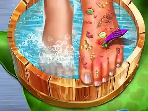 Gêm Feet Skin Doctor ar-lein