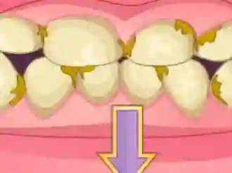 Gêm Bad Teeth Makeover ar-lein