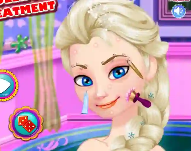 Gêm Ice Queen Acne Treatment ar-lein