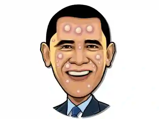 Gêm Celebrity Pimple Pop ar-lein
