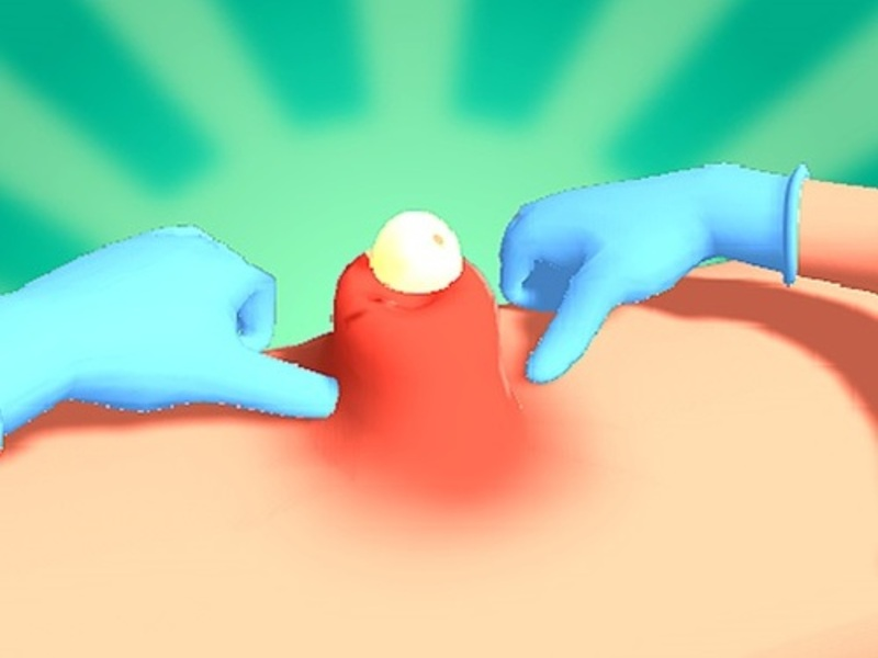 Gêm Gwasgfa pimple ar-lein