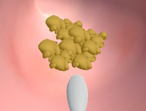Gêm Clinig Earwax  ar-lein